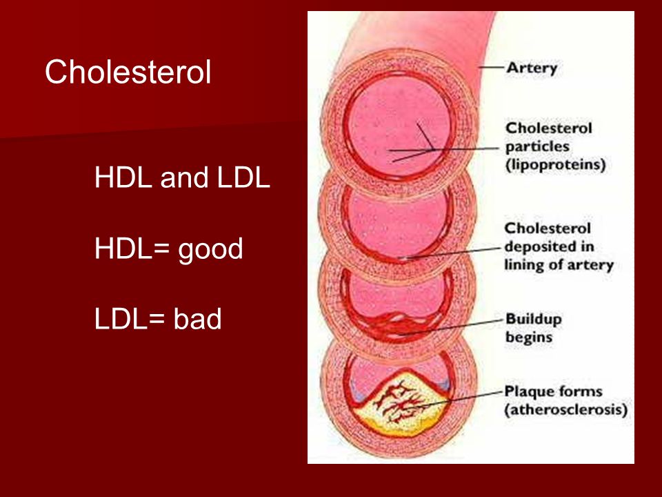 Cholesterol HDL and LDL HDL= good LDL= bad