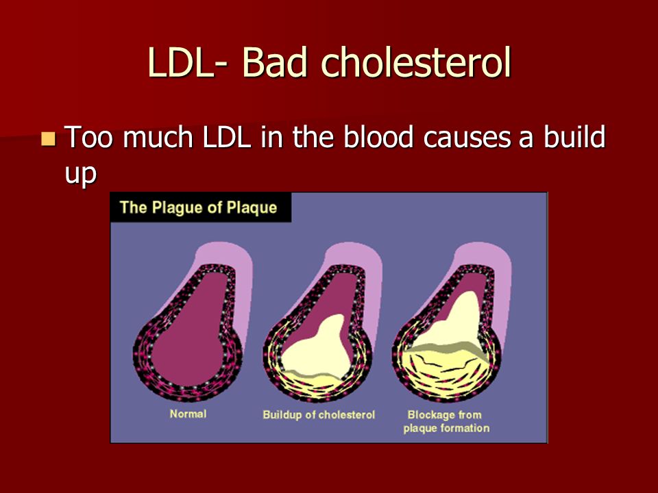 LDL- Bad cholesterol Too much LDL in the blood causes a build up Too much LDL in the blood causes a build up
