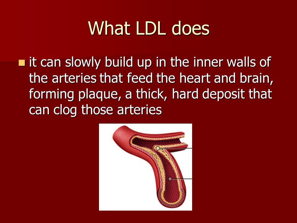 What LDL does it can slowly build up in the inner walls of the arteries that feed the heart and brain, forming plaque, a thick, hard deposit that can clog those arteries it can slowly build up in the inner walls of the arteries that feed the heart and brain, forming plaque, a thick, hard deposit that can clog those arteries