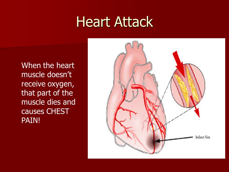 Heart Attack When the heart muscle doesn’t receive oxygen, that part of the muscle dies and causes CHEST PAIN!