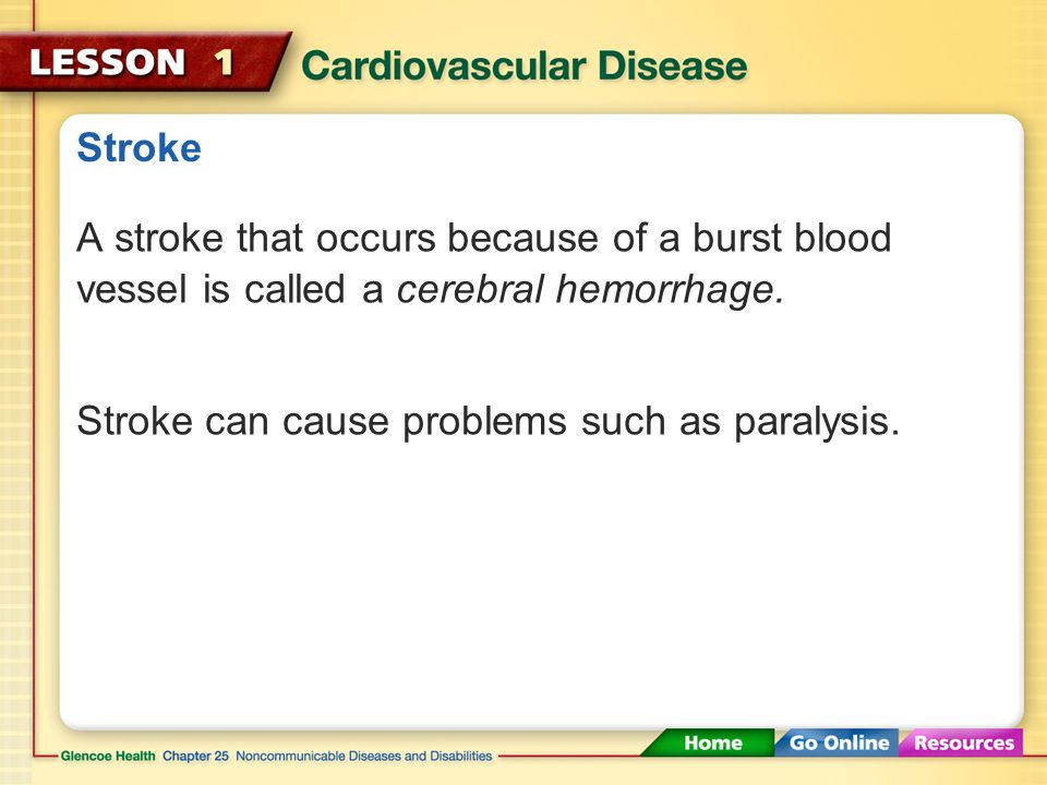 Stroke Sometimes an artery supplying blood to the brain becomes blocked or bursts, resulting in a stroke.
