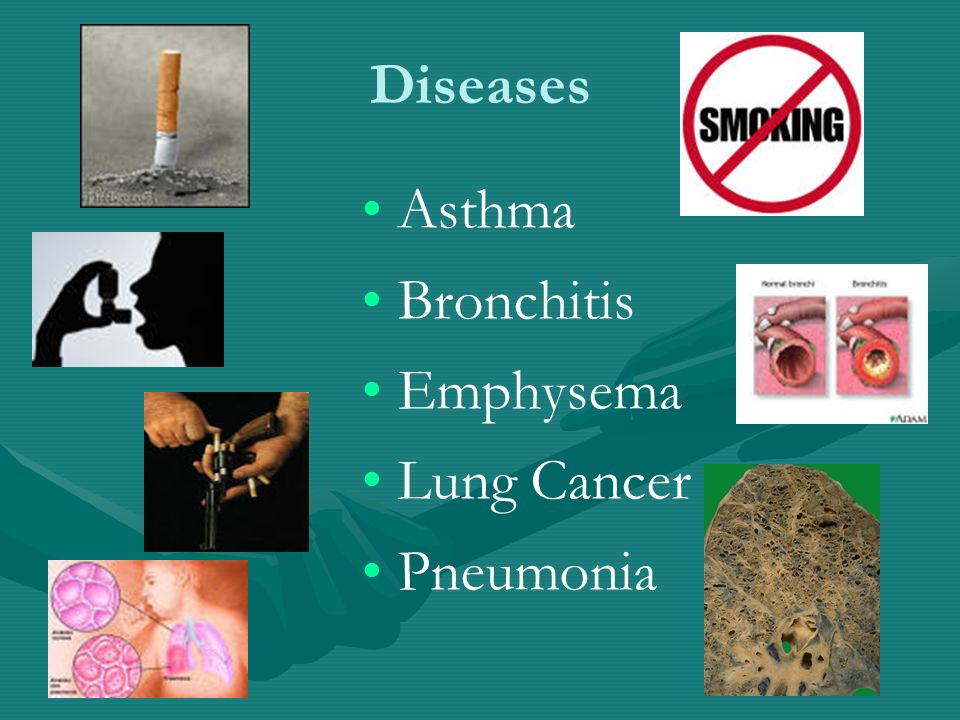 Diseases Asthma Bronchitis Emphysema Lung Cancer Pneumonia