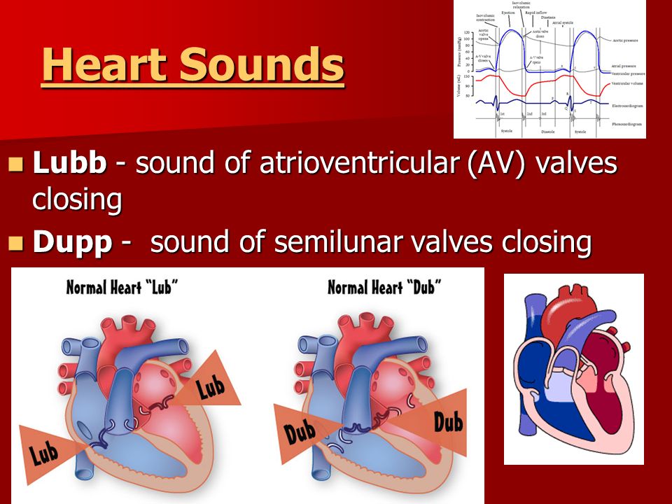Image result for heart lubb dupp