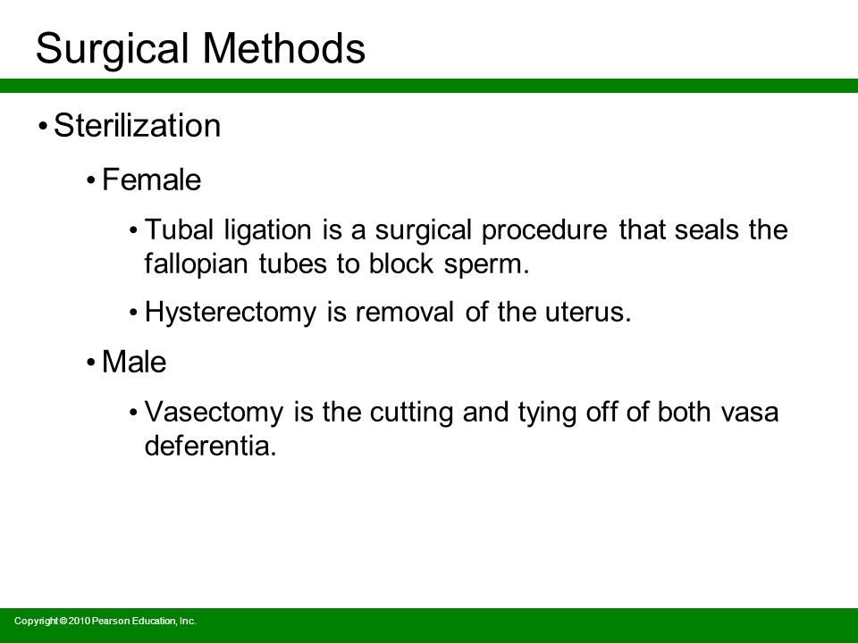 Surgical Methods Sterilization Female Tubal ligation is a surgical procedure that seals the fallopian tubes to block sperm.