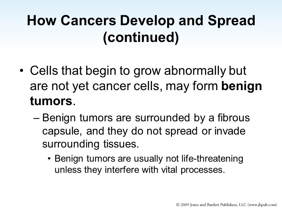 how cancers develop and spread cancer develops only in cells with how do cancer form