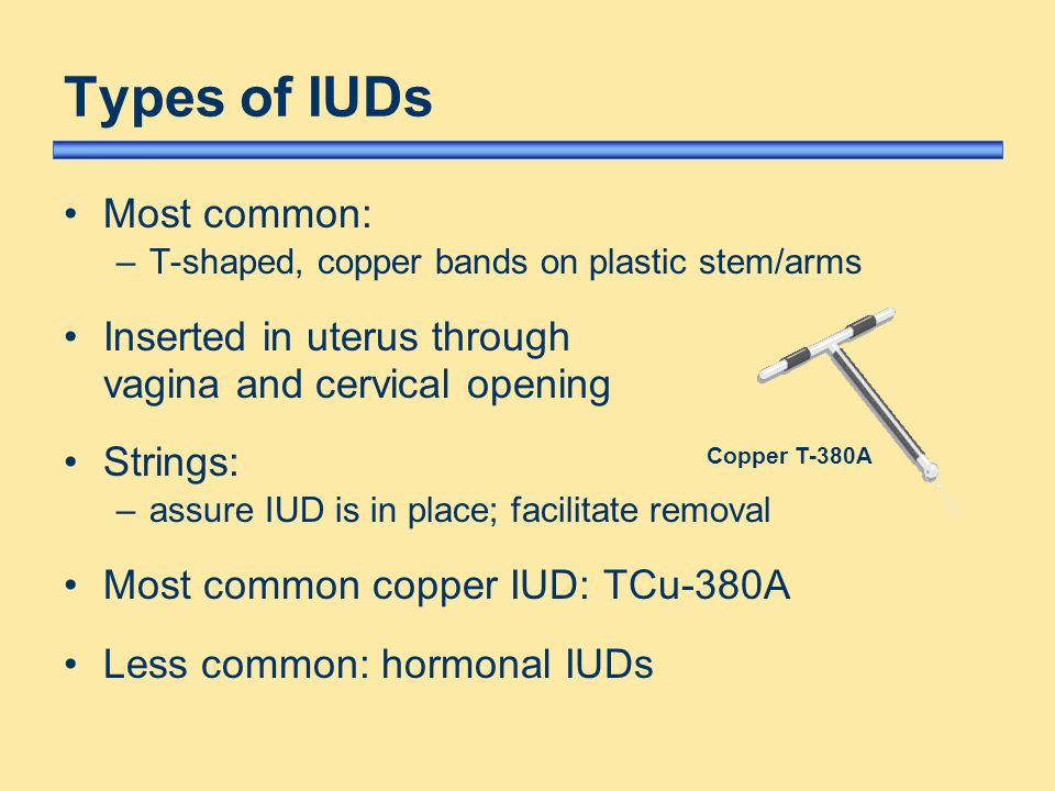 iud types