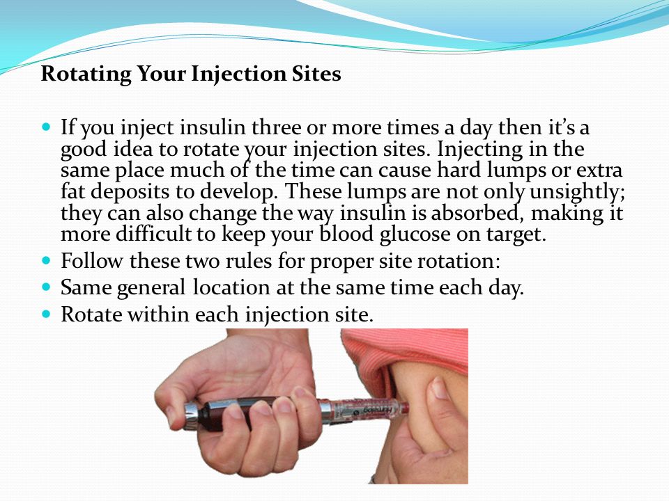 Rotating insulin injections