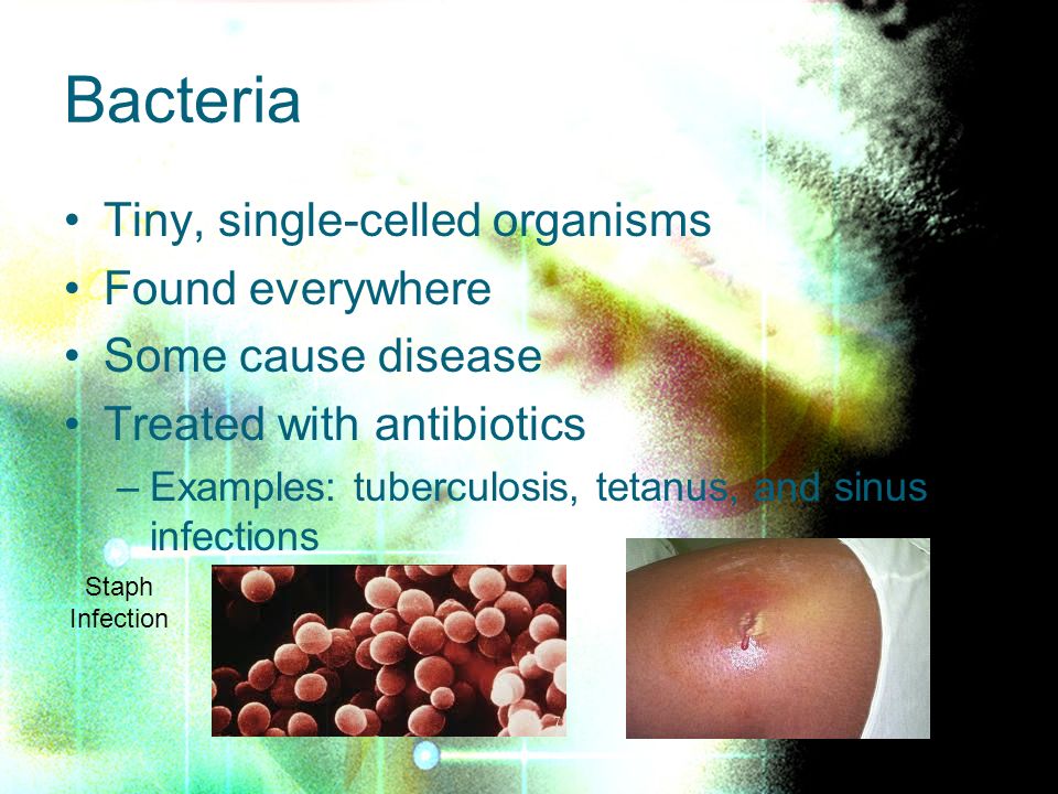 viruses fungi protozoa bacteria info essay C gram-positive bacteria d fungi e protozoans when comparing the types of viruses that infect bacteria essay questions answer all parts of the following. viruses fungi protozoa bacteria info essay C gram-positive bacteria d fungi e protozoans when comparing the types of viruses that infect bacteria essay questions answer all parts of the following.