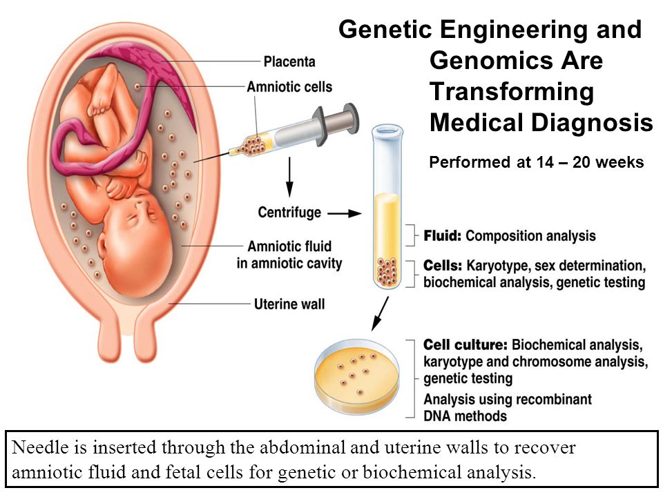 Performed at 14 – 20 weeks Needle is inserted through the abdominal and uterine walls to recover amniotic fluid and fetal cells for genetic or biochemical analysis.