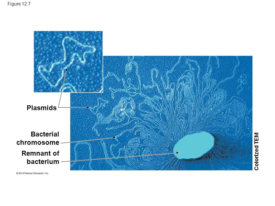 Figure 12.7 Plasmids Bacterial chromosome Remnant of bacterium Colorized TEM