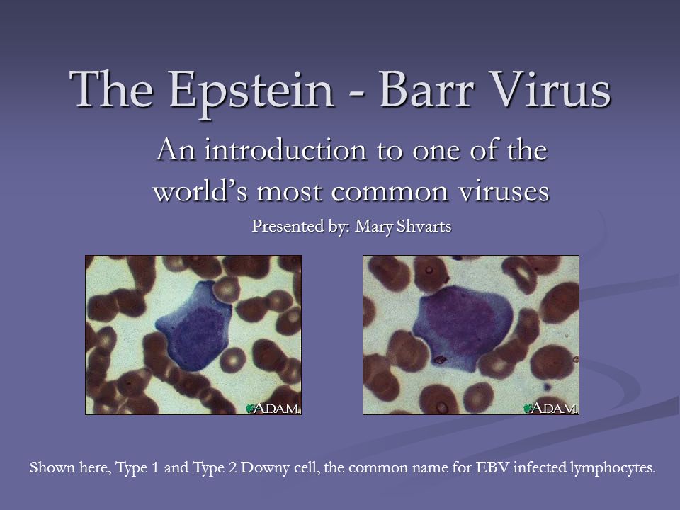 the description of the epstein barr virus ebv Eber epstein-barr virus by ish add to favorites methodology in situ hybridization (ish) test description this probe set labels all latent ebv-infected cells. the description of the epstein barr virus ebv Eber epstein-barr virus by ish add to favorites methodology in situ hybridization (ish) test description this probe set labels all latent ebv-infected cells.
