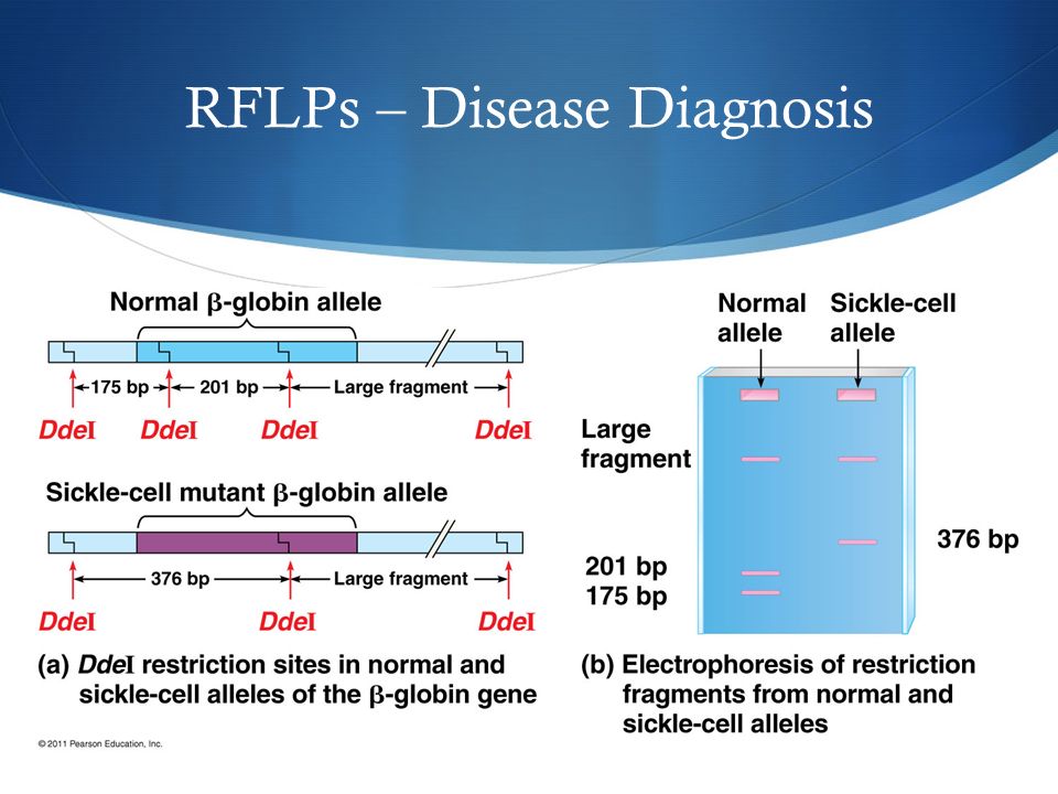 RFLPs – Disease Diagnosis