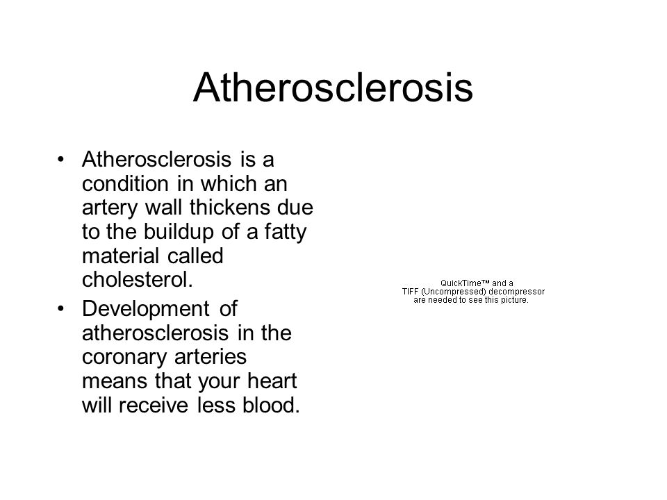 Atherosclerosis Atherosclerosis is a condition in which an artery wall thickens due to the buildup of a fatty material called cholesterol.