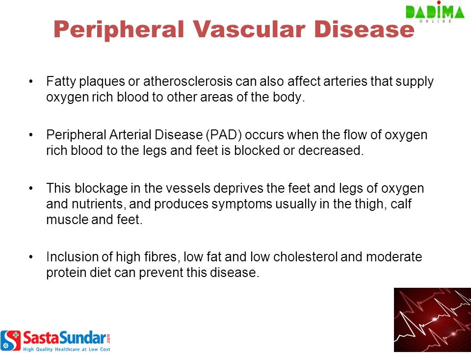 Fatty plaques or atherosclerosis can also affect arteries that supply oxygen rich blood to other areas of the body.