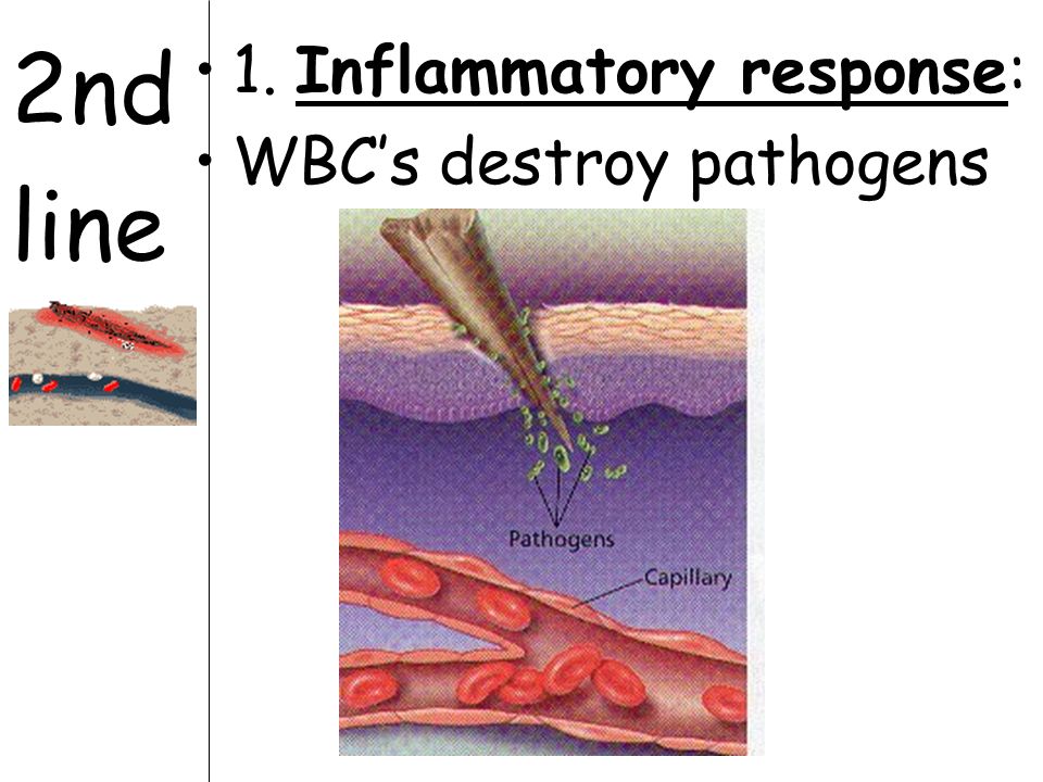 2nd line 1. Inflammatory response: WBC’s destroy pathogens