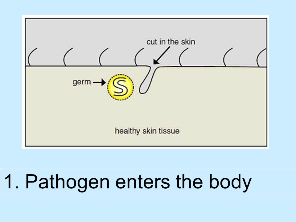 1. Pathogen enters the body