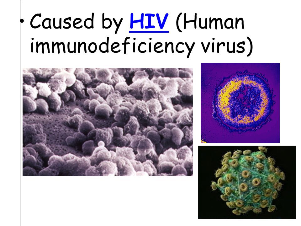 Caused by HIV (Human immunodeficiency virus)