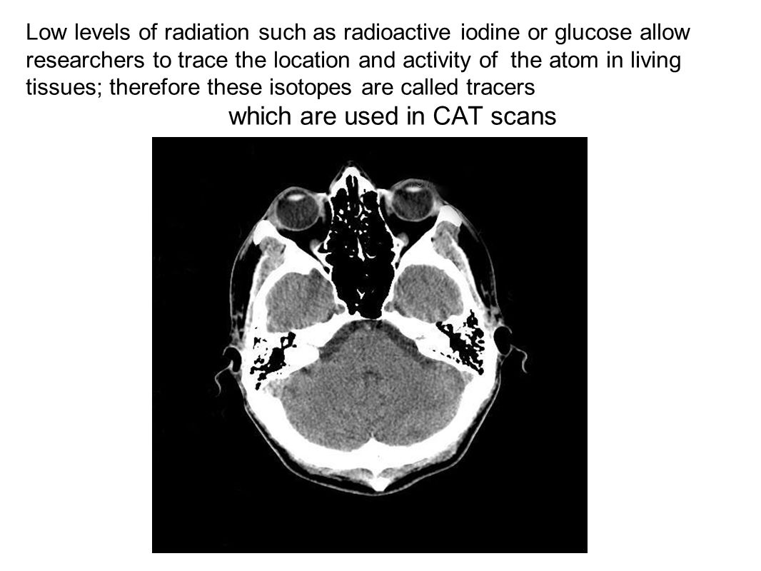Low levels of radiation such as radioactive iodine or glucose allow researchers to trace the location and activity of the atom in living tissues; therefore these isotopes are called tracers which are used in CAT scans