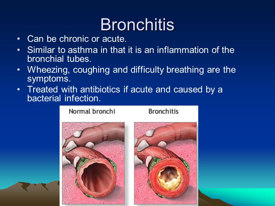 Bronchitis Can be chronic or acute.