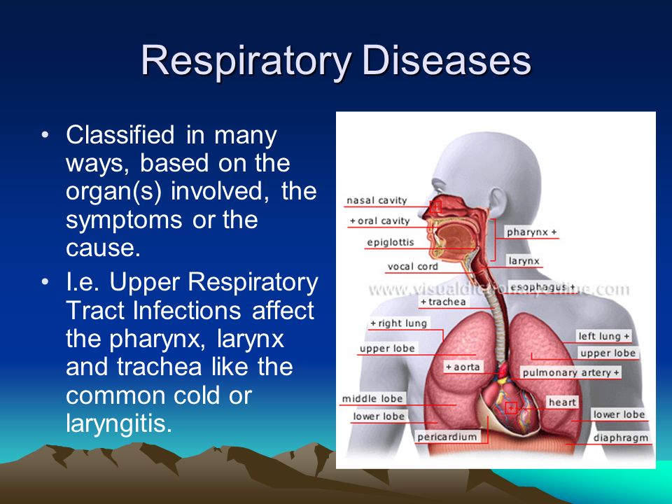 Respiratory Diseases Classified in many ways, based on the organ(s) involved, the symptoms or the cause.
