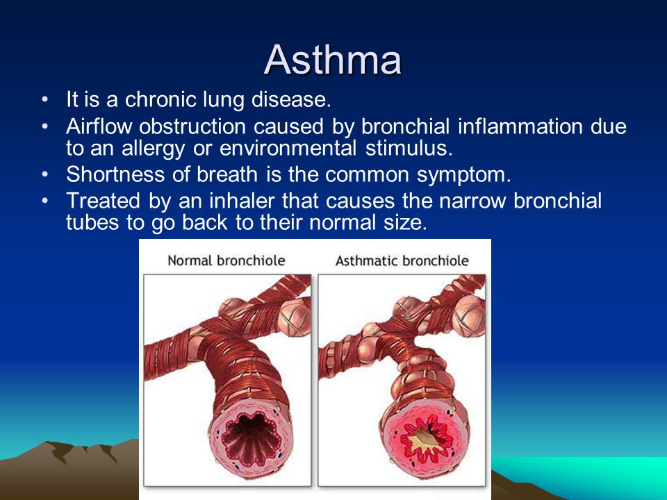 Asthma It is a chronic lung disease.