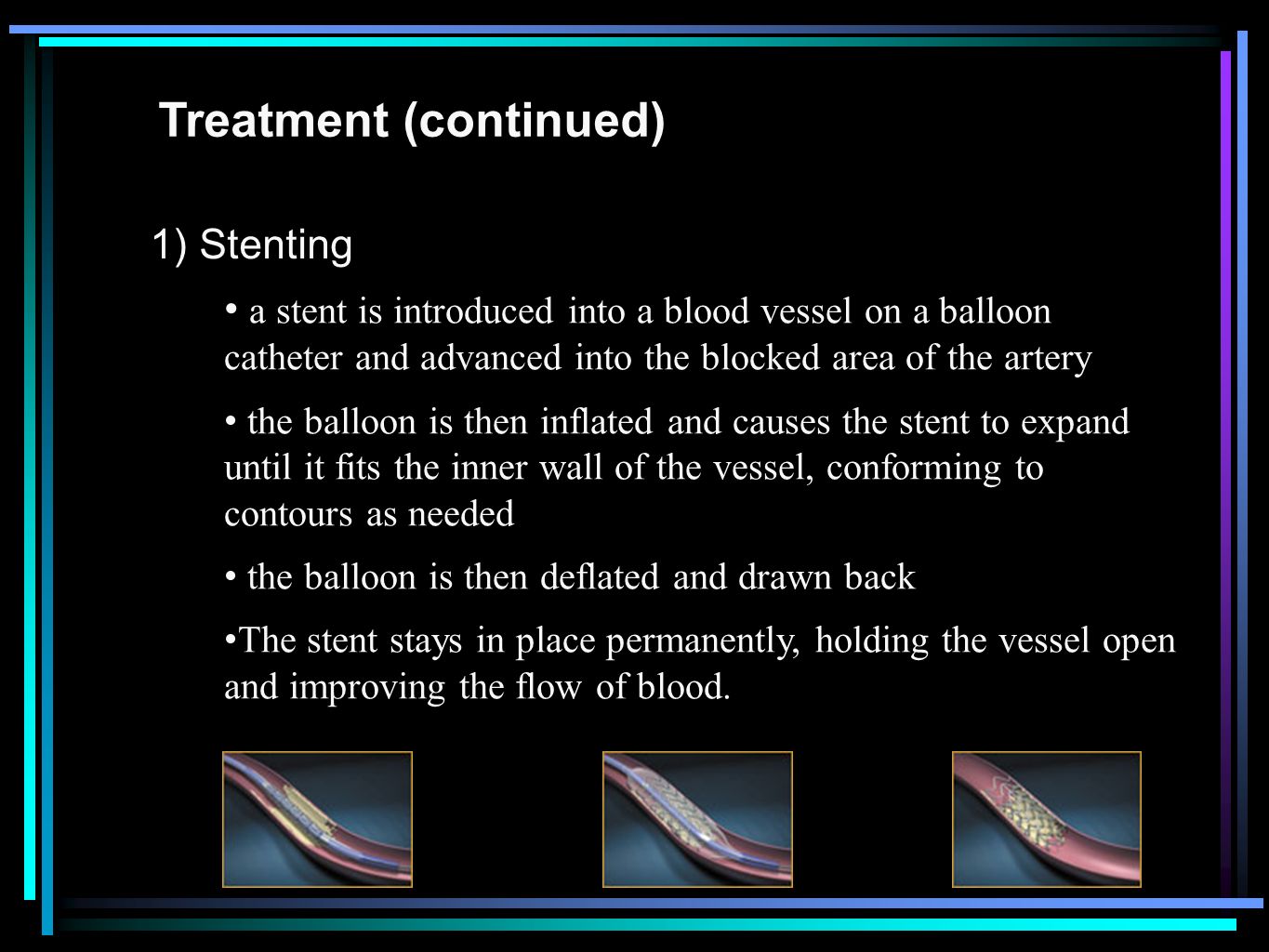 Treatment (continued) 1) Stenting a stent is introduced into a blood vessel on a balloon catheter and advanced into the blocked area of the artery the balloon is then inflated and causes the stent to expand until it fits the inner wall of the vessel, conforming to contours as needed the balloon is then deflated and drawn back The stent stays in place permanently, holding the vessel open and improving the flow of blood.