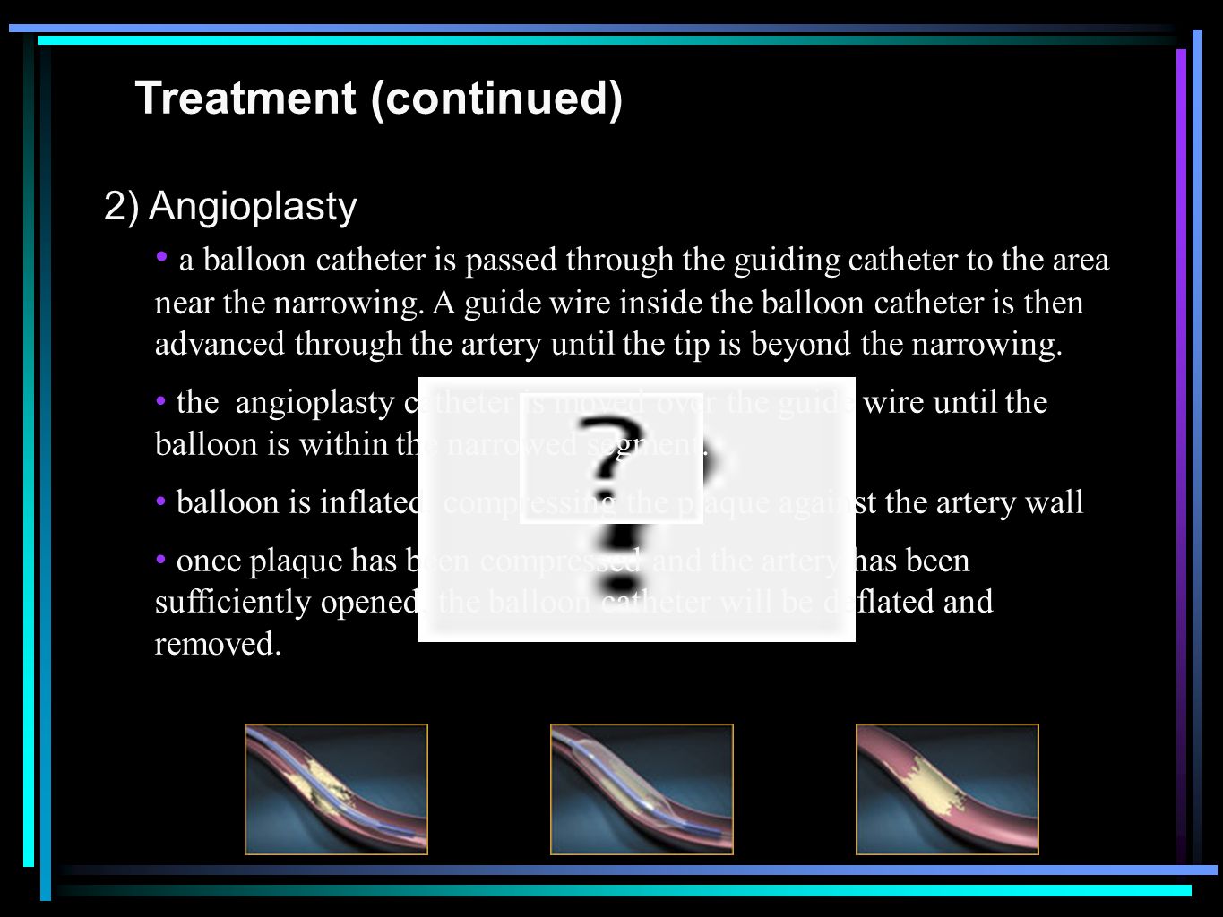 Treatment (continued) 2) Angioplasty a balloon catheter is passed through the guiding catheter to the area near the narrowing.