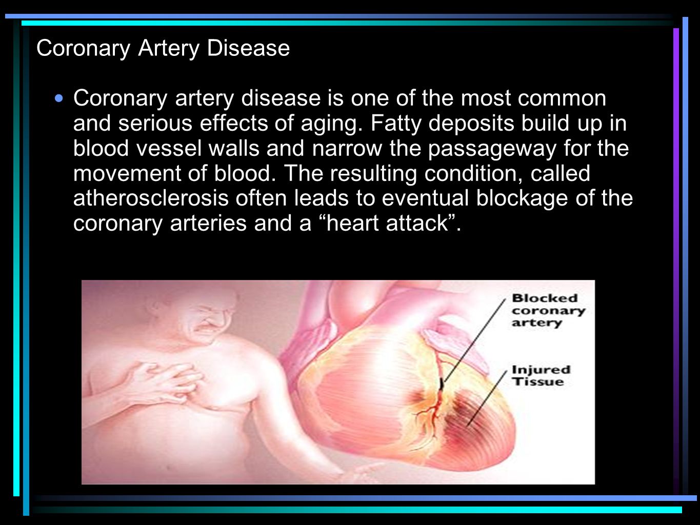 Coronary Artery Disease Coronary artery disease is one of the most common and serious effects of aging.