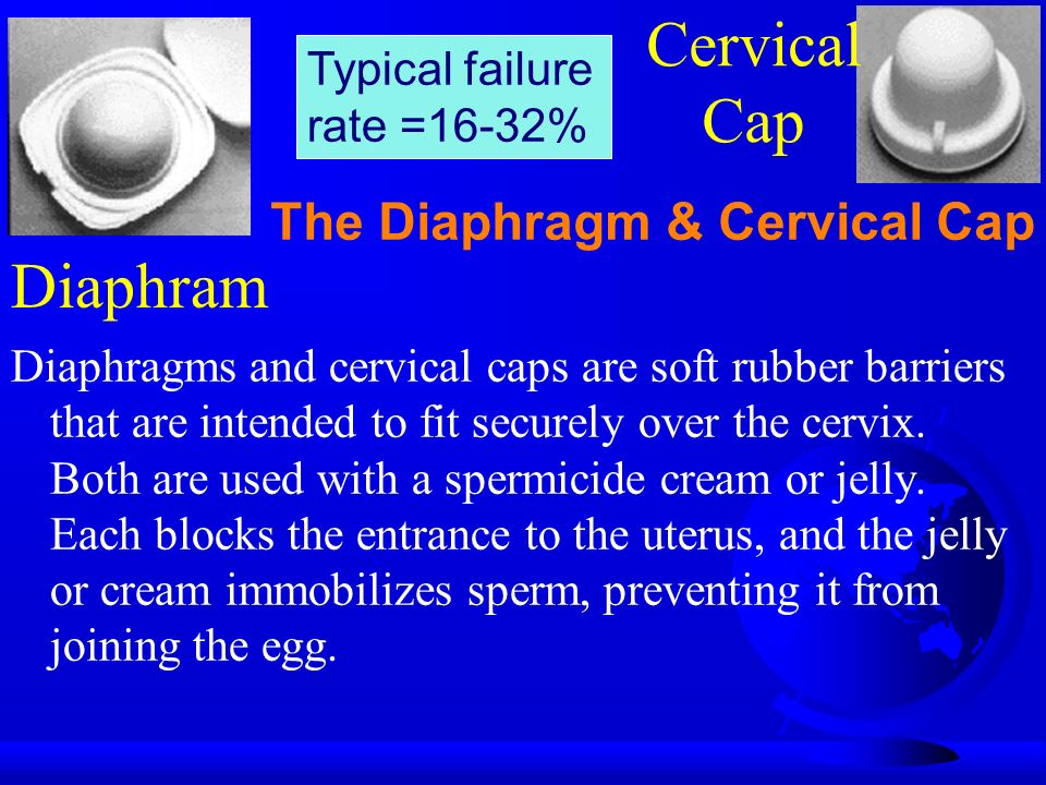 Diaphram Diaphragms and cervical caps are soft rubber barriers that are intended to fit securely over the cervix.