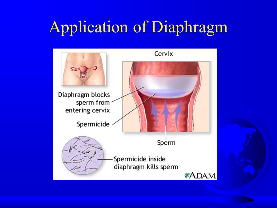 Application of Diaphragm