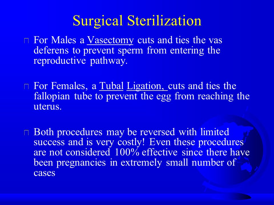 Surgical Sterilization  For Males a Vasectomy cuts and ties the vas deferens to prevent sperm from entering the reproductive pathway.