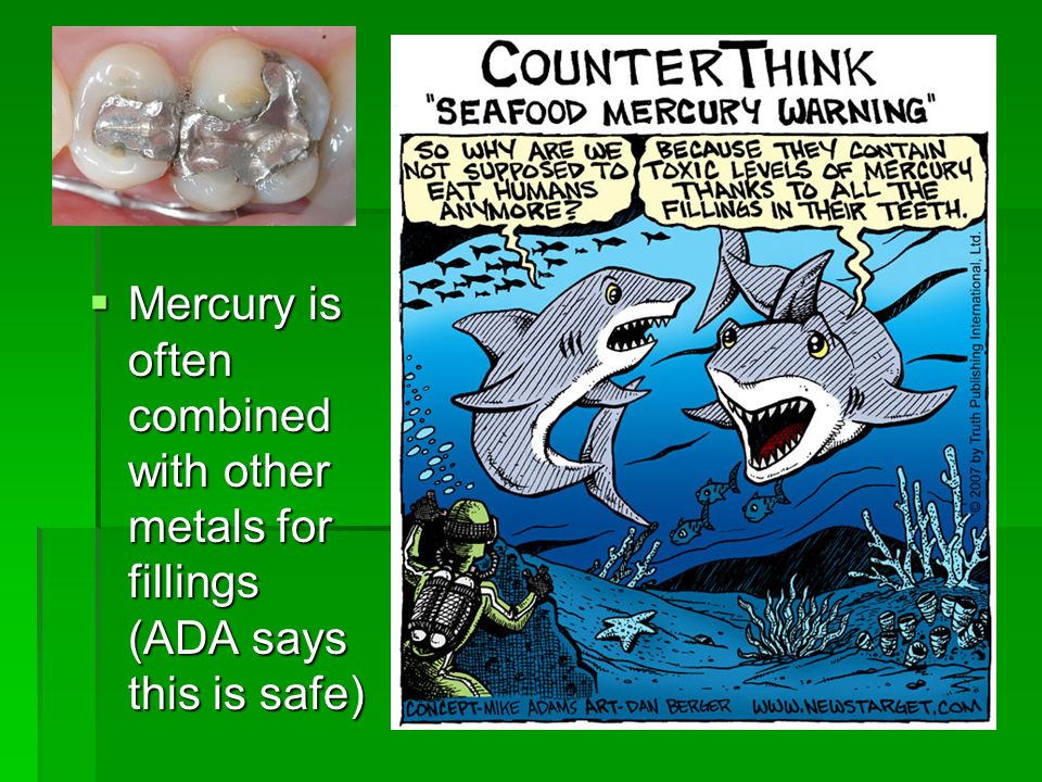  Mercury is often combined with other metals for fillings (ADA says this is safe)