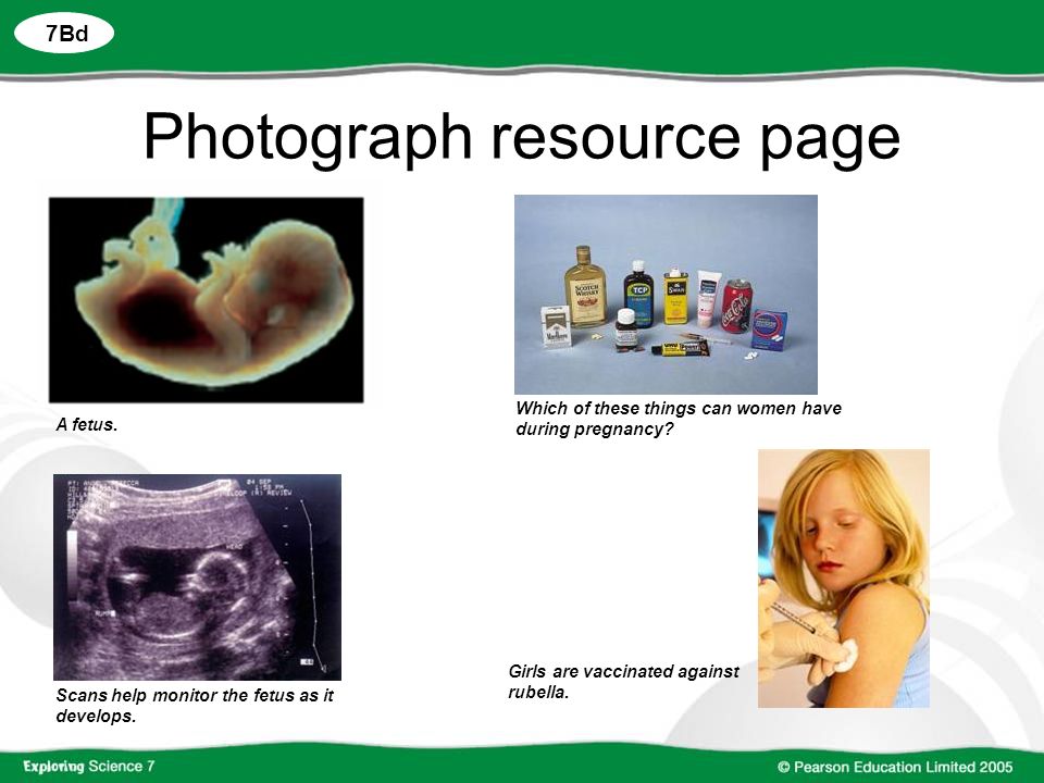 7Bd Photograph resource page Which of these things can women have during pregnancy.