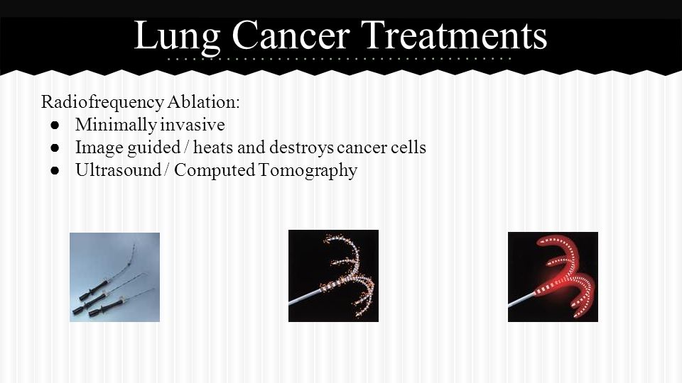 Lung Cancer ● Abnormal cells from a tumor in lungs ● Symptoms hard to spot in early stages ● Causes most cancer deaths worldwide ● Smoking is the #1 cause ● Major symptoms: Coughing, chest pain, lung infections, etc.