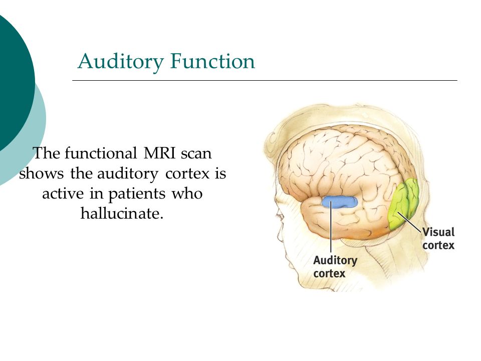 Auditory Function The functional MRI scan shows the auditory cortex is active in patients who hallucinate.