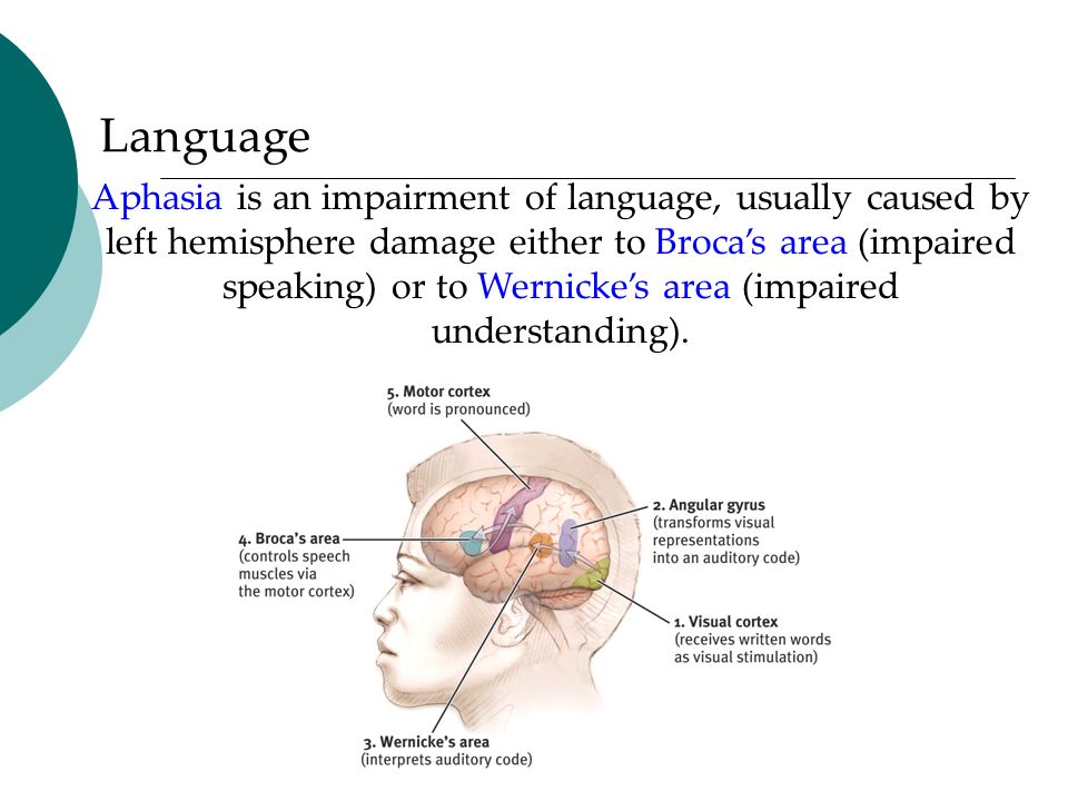 Language Aphasia is an impairment of language, usually caused by left hemisphere damage either to Broca’s area (impaired speaking) or to Wernicke’s area (impaired understanding).