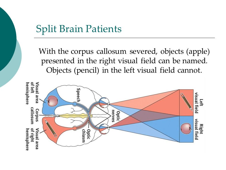 Split Brain Patients With the corpus callosum severed, objects (apple) presented in the right visual field can be named.