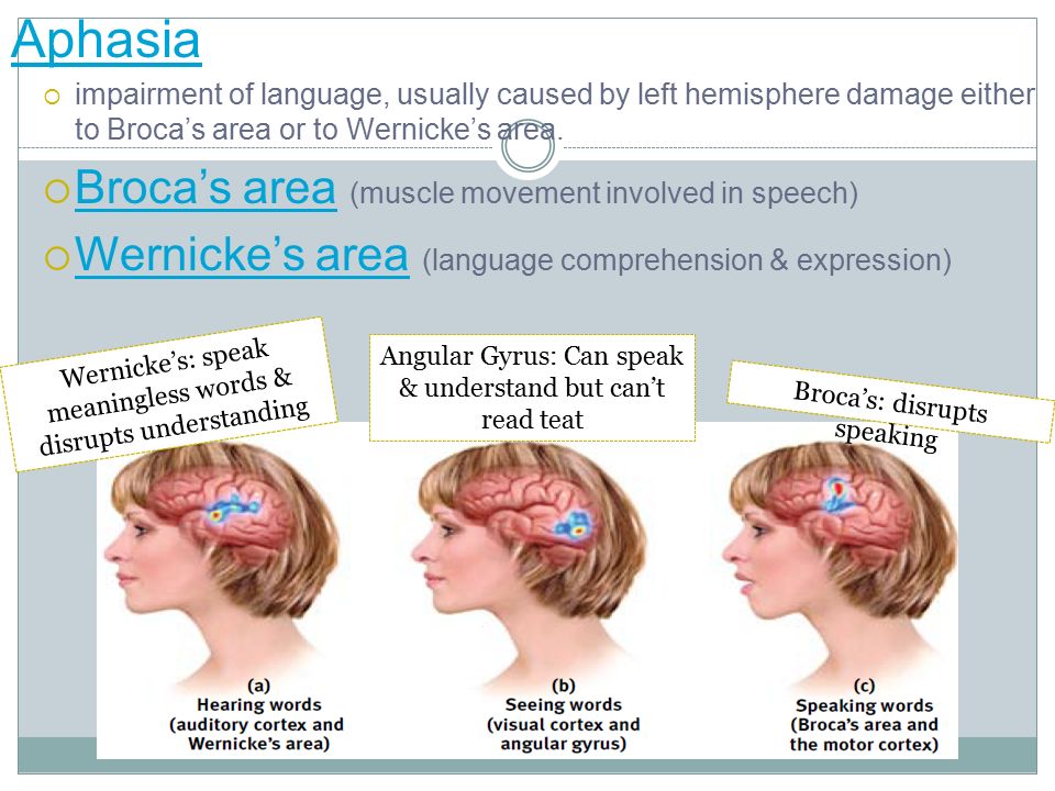 Aphasia  impairment of language, usually caused by left hemisphere damage either to Broca’s area or to Wernicke’s area.
