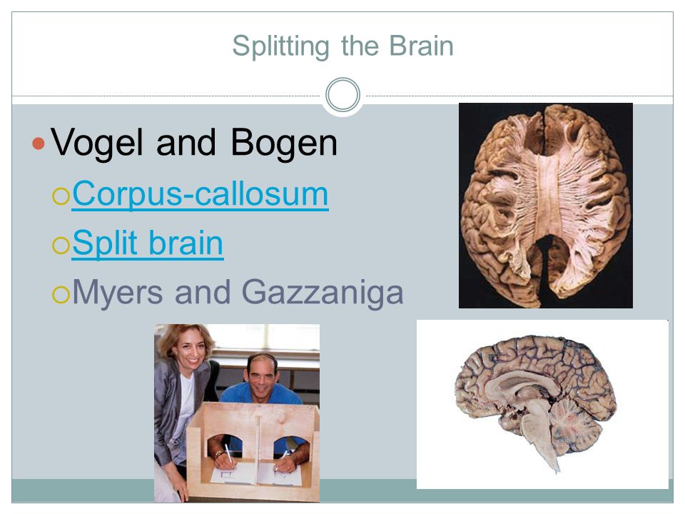 Splitting the Brain Vogel and Bogen  Corpus-callosum Corpus-callosum  Split brain Split brain  Myers and Gazzaniga