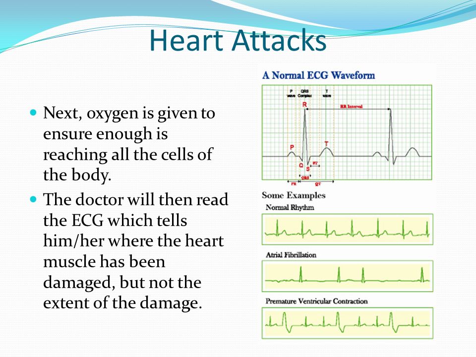 Heart Attacks Next, oxygen is given to ensure enough is reaching all the cells of the body.
