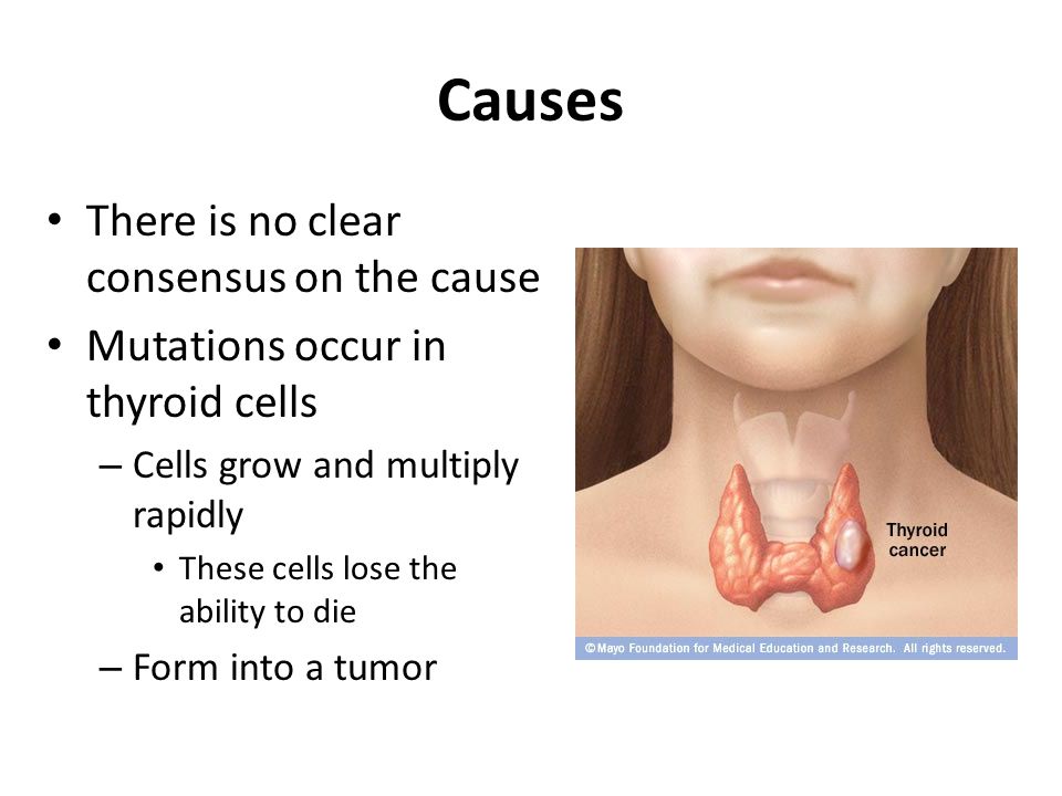 thyroid cancer thyroid cancer