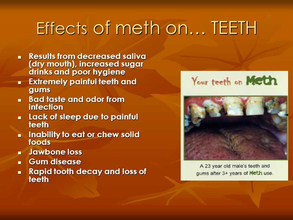 the effects of methamphetamine on the Find patient medical information for methamphetamine oral on webmd including its uses, side effects and safety, interactions, pictures, warnings and user ratings. the effects of methamphetamine on the Find patient medical information for methamphetamine oral on webmd including its uses, side effects and safety, interactions, pictures, warnings and user ratings.