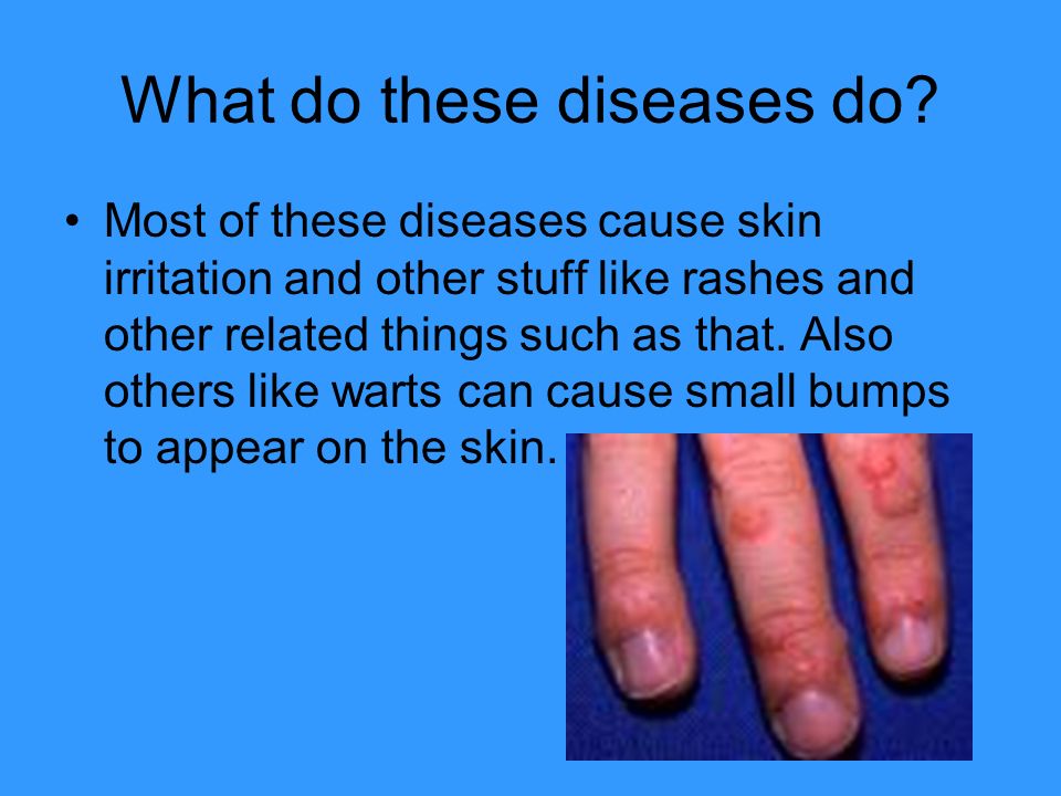 What do these diseases do.