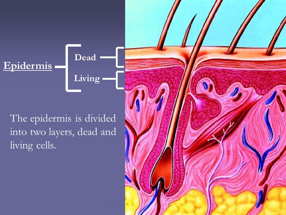 Epidermis The epidermis is divided into two layers, dead and living cells. Dead Living