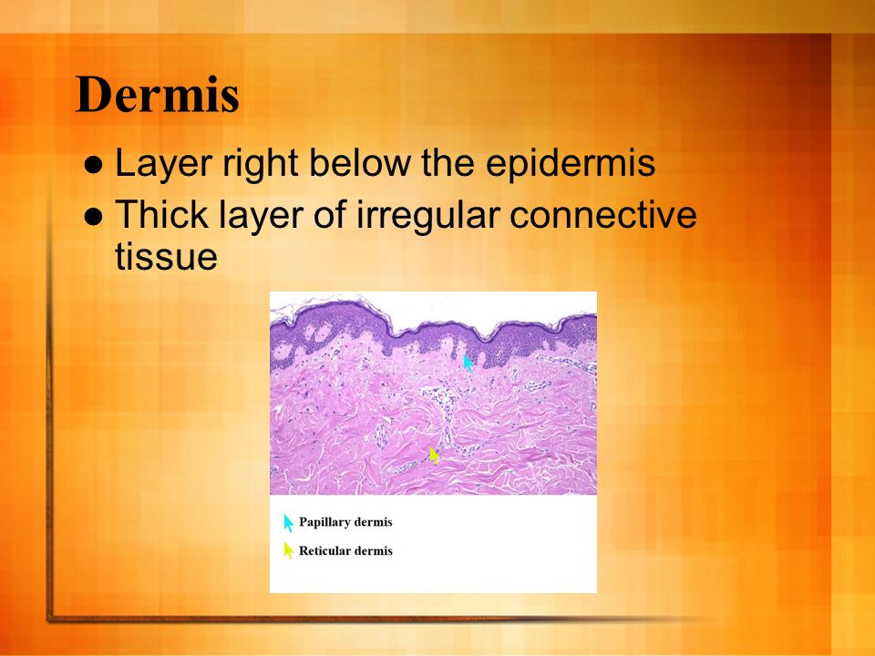Dermis Layer right below the epidermis Thick layer of irregular connective tissue