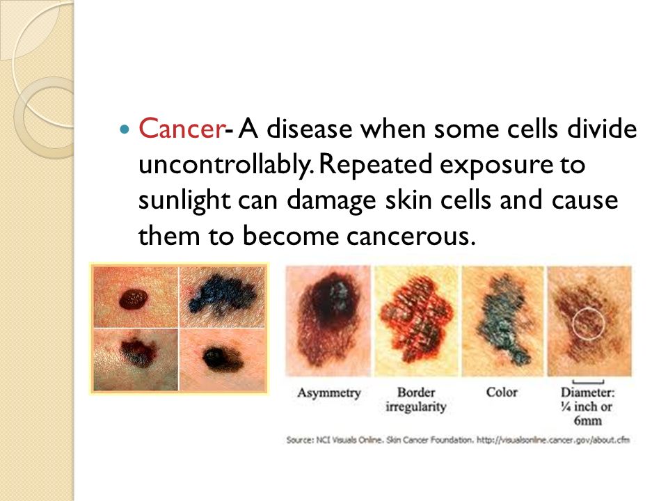 Cancer- A disease when some cells divide uncontrollably.