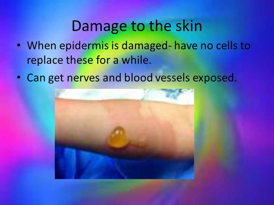 Damage to the skin When epidermis is damaged- have no cells to replace these for a while.