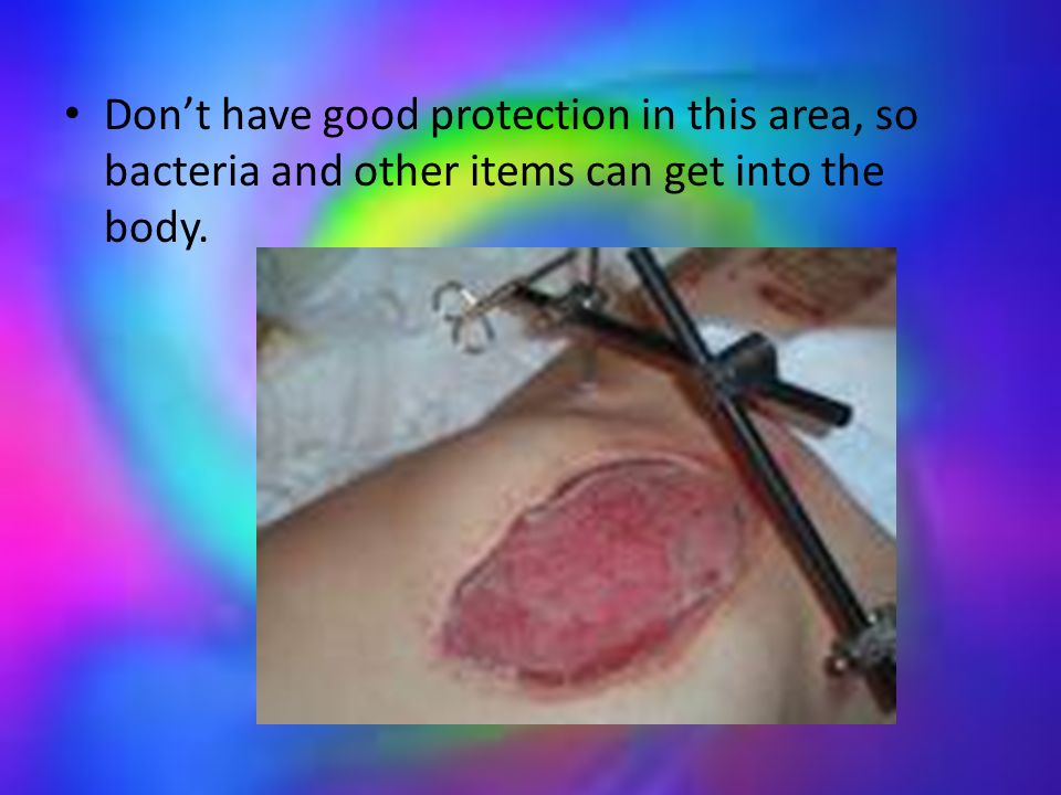 Don’t have good protection in this area, so bacteria and other items can get into the body.