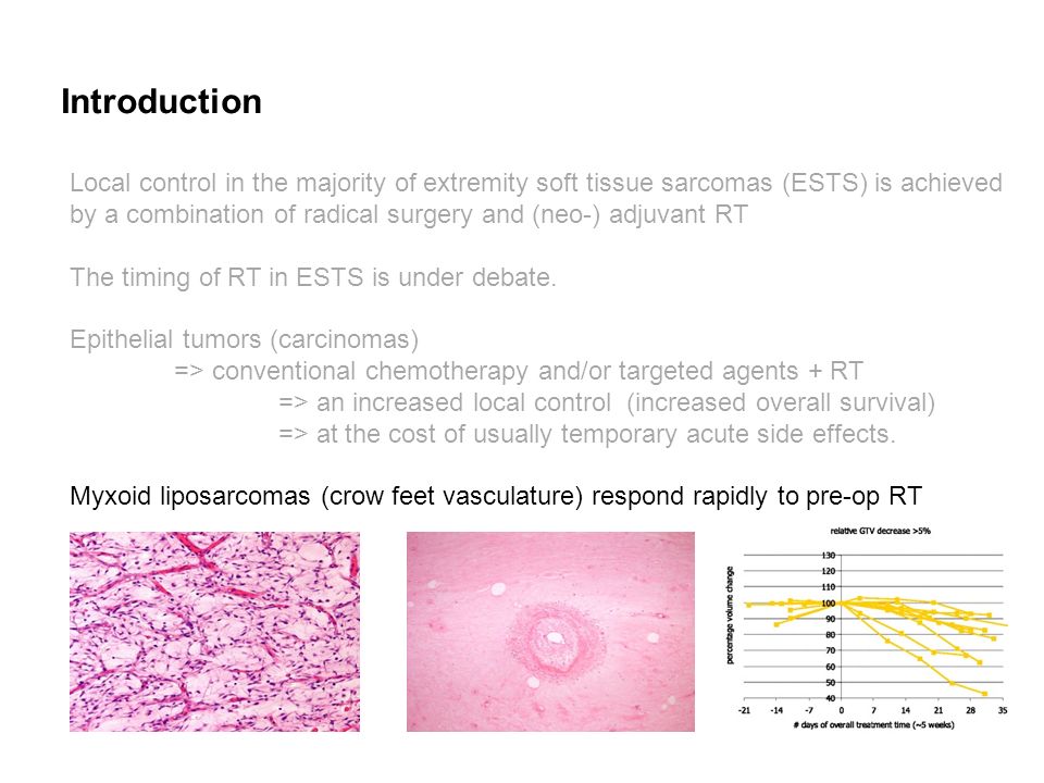 Introduction Local control in the majority of extremity soft tissue sarcomas (ESTS) is achieved by a combination of radical surgery and (neo-) adjuvant RT The timing of RT in ESTS is under debate.