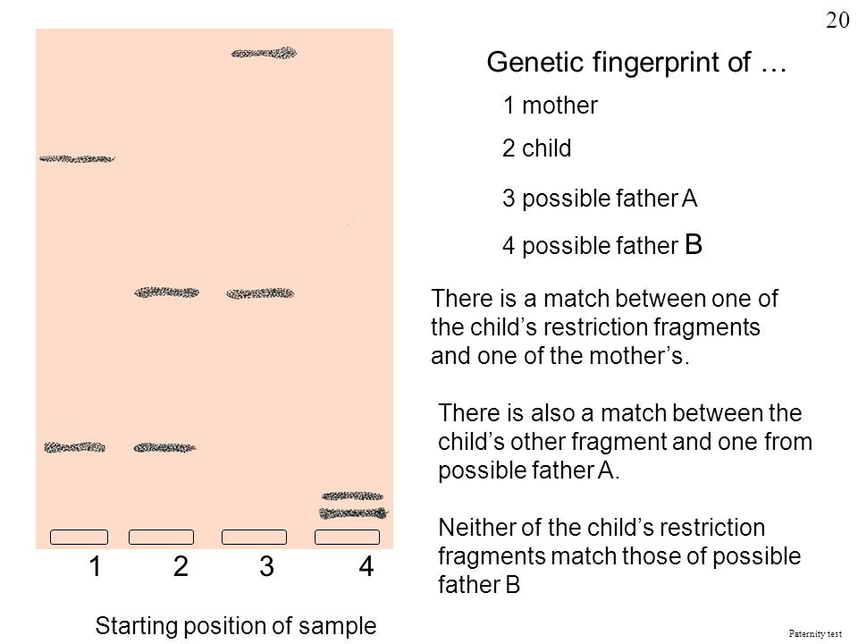 Starting position of sample 1234 Genetic fingerprint of … 1 mother 2 child 3 possible father A 4 possible father B There is a match between one of the child’s restriction fragments and one of the mother’s.